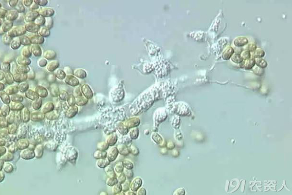 显微镜下的木霉菌